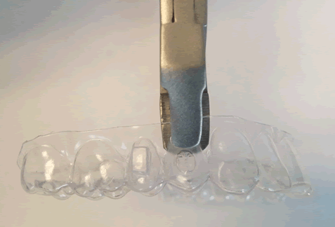Rotations - How to Rotate Teeth with Auxiliaries