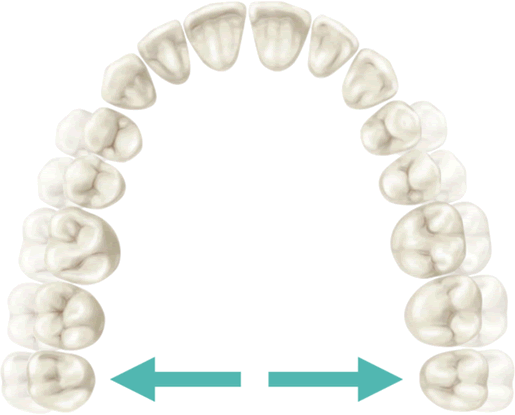 Tooth Movements