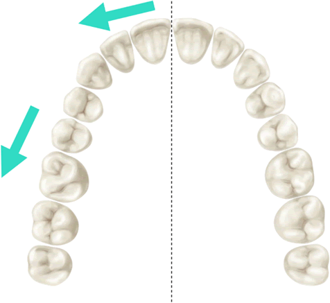 Tooth Movements