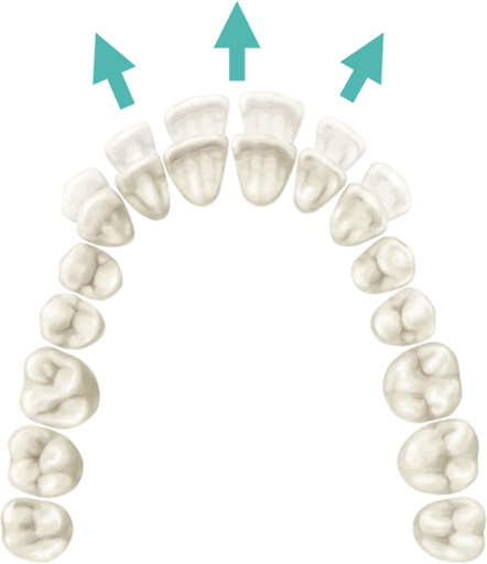 Tooth Movements