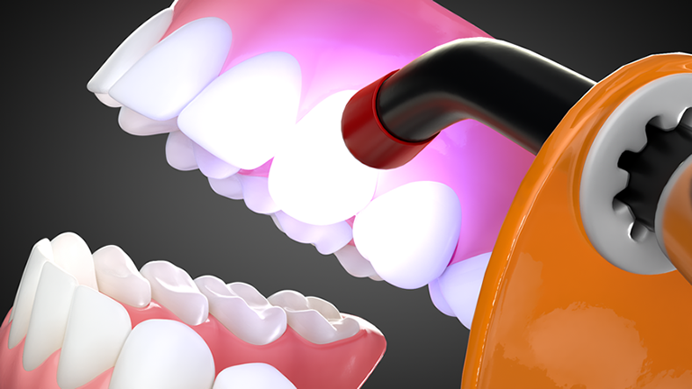 Engagers - How to place