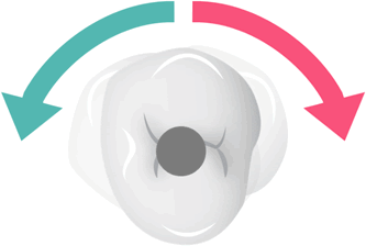 Tooth Movements