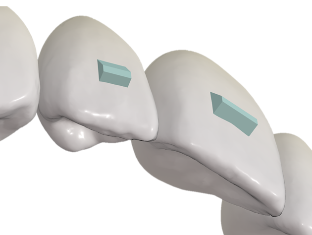 Engagers (also known as Attachments)