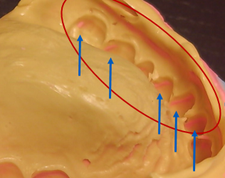double_imprint_2.PNG