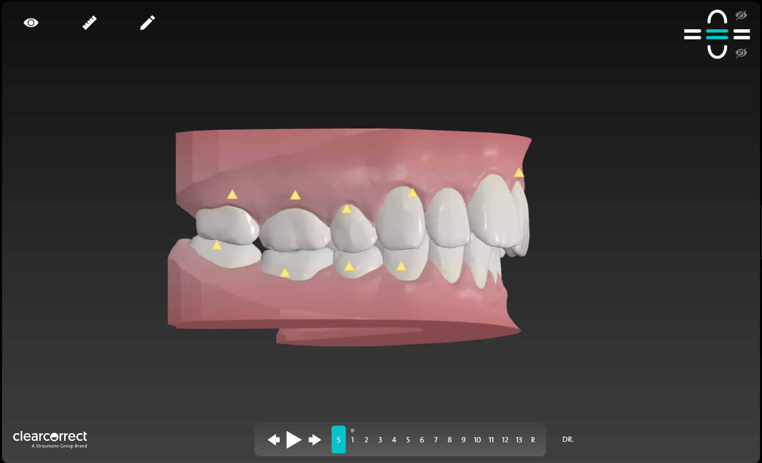 Treatment_Setup_Image_3__1_.jpg