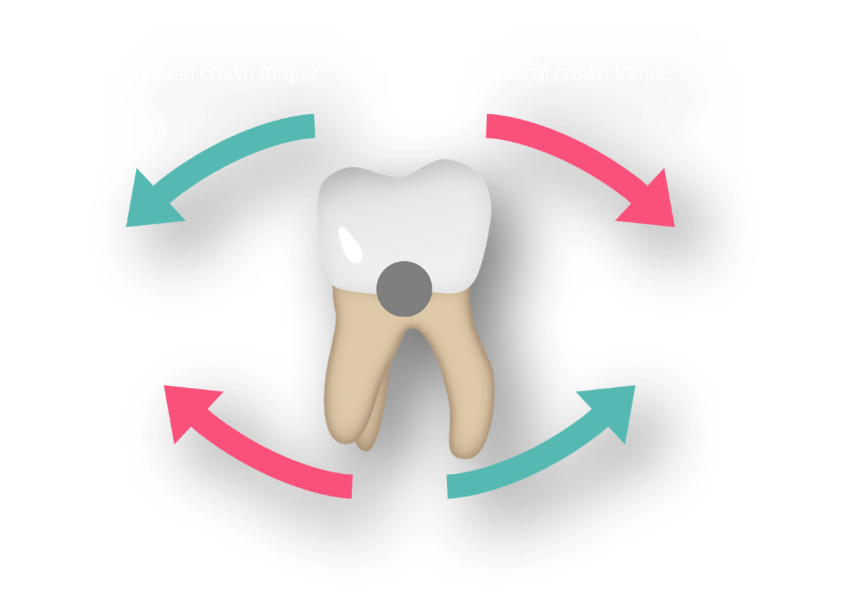 posterior Torque image.png