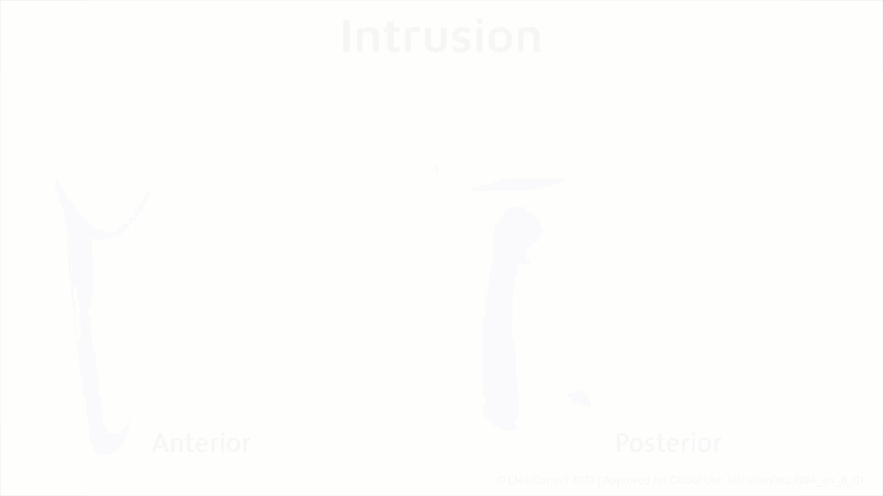 Intrusion (1).gif