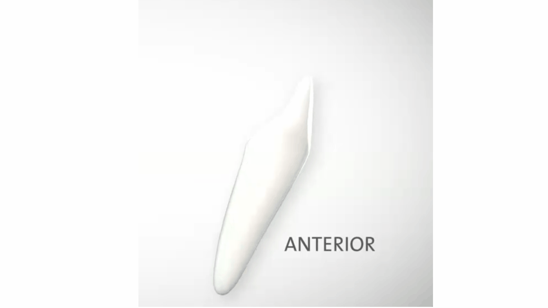 Anterior Torquing_V2.gif