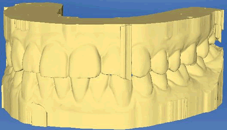 4408260871959_Excess_Material_01.gif