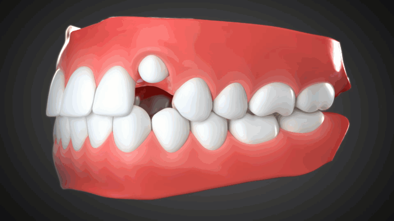 Guides_3D_Animation.gif
