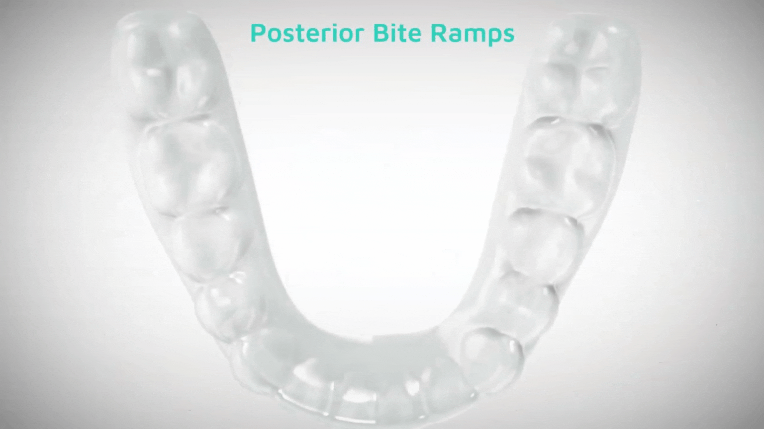 Posterior cut 3 (1).gif