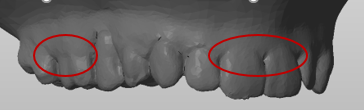 insufficient_material_scan.PNG