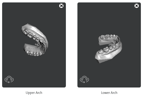 Both_Arches__1_.png