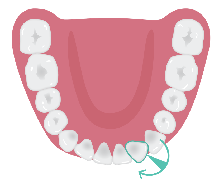 Significant_anterior_rotations_v2.png