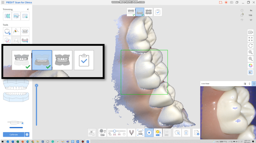 Lower_Arch_Scan.png