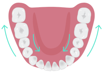 Distalization_or_mesialization_of_posterior_teeth.png