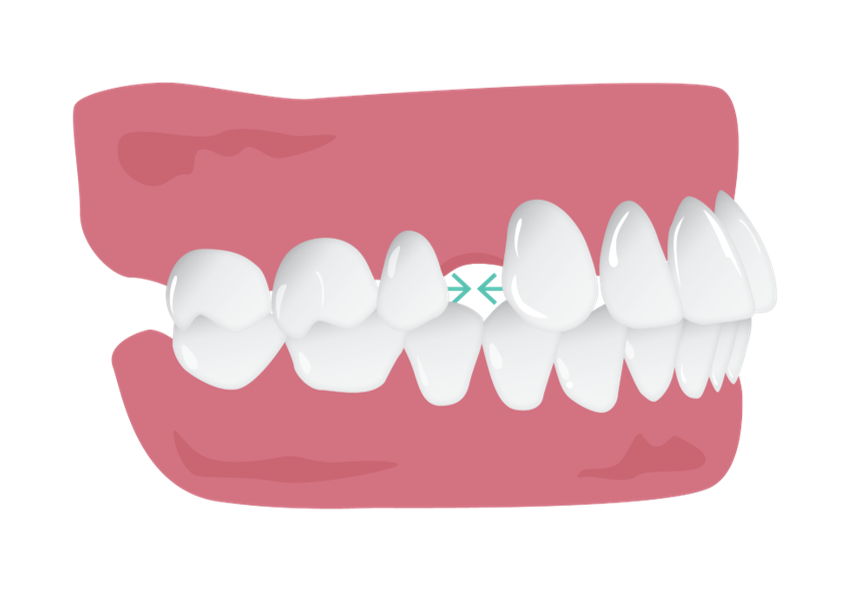 Large_space_closure_-_small_borders.png