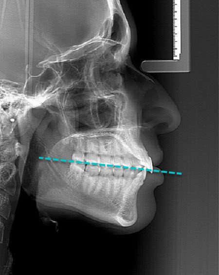 Clinical_photos_HC_1.jpg