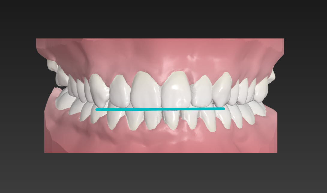 Clinical Photos 1.jpg