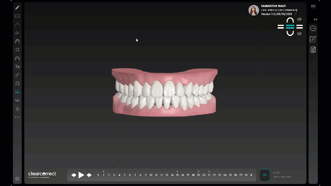 禁用可扩展左侧 Menu_10.24.gif