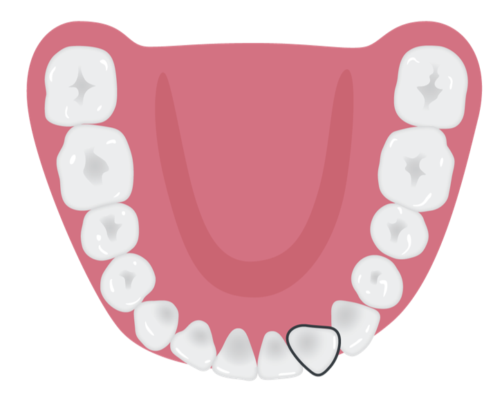 rotated_tooth_3.png
