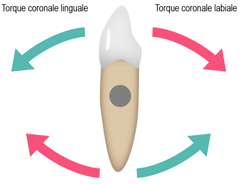 Torque_IT.png