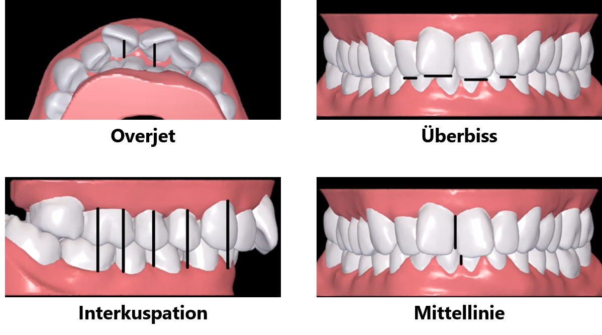 Treatment_setup_-_compare_-_all_-_DE.png