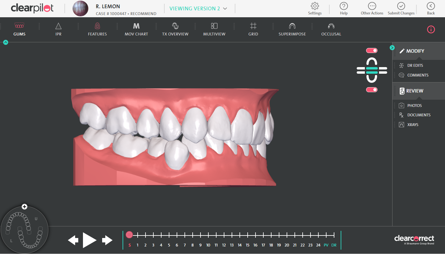 Evaluate_Treatment_Setup.png