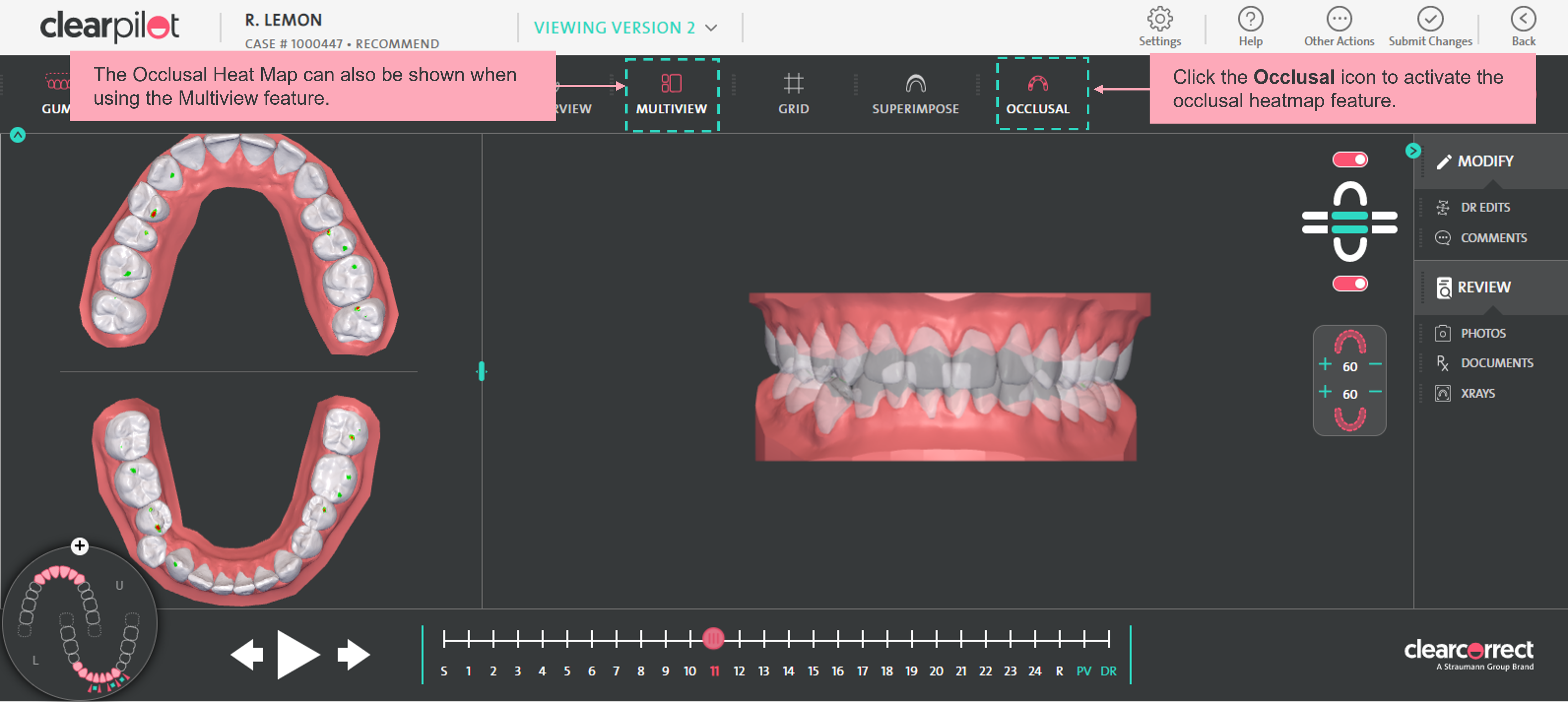 Multiview_Occlusal.png