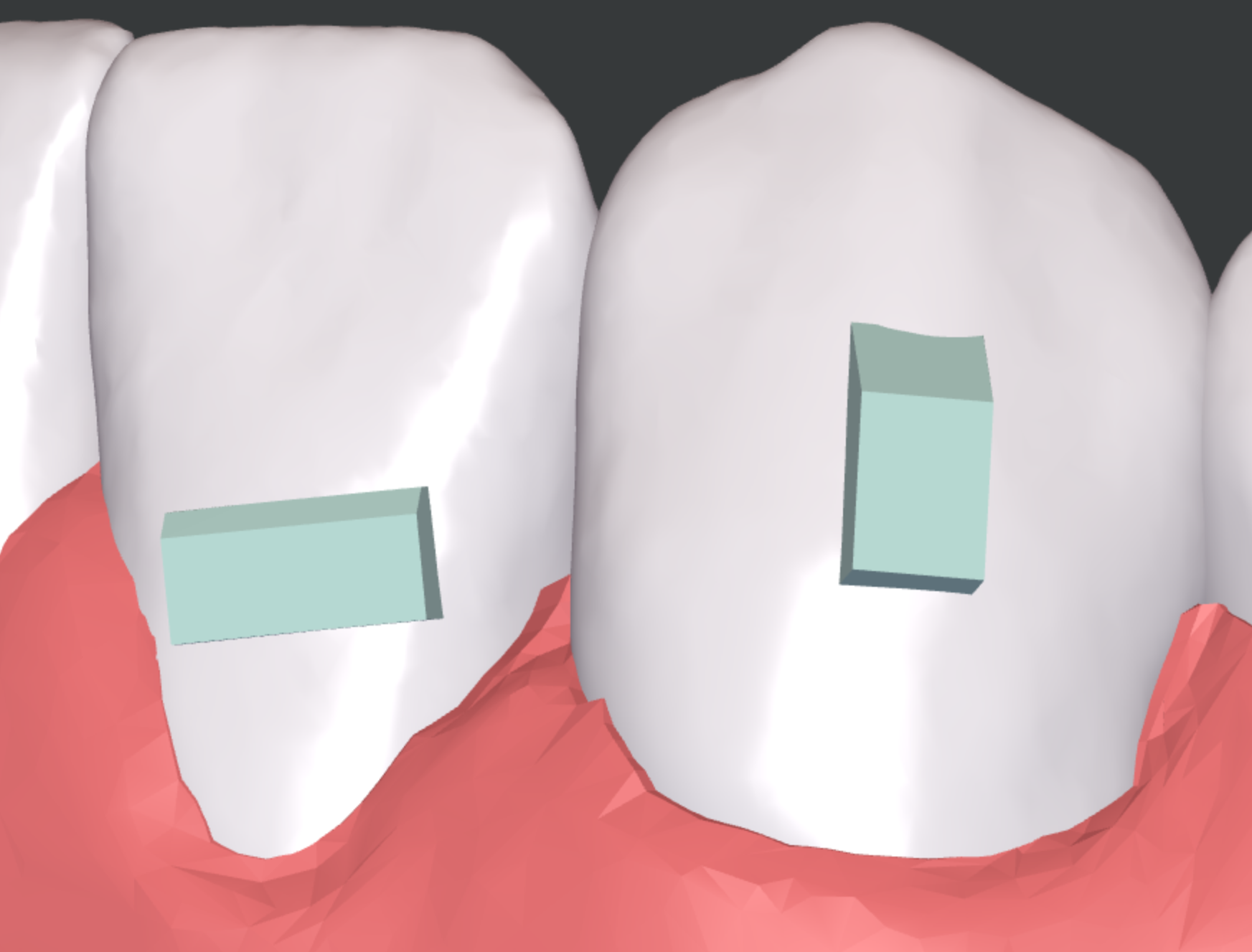 Engager_-_bevel.png